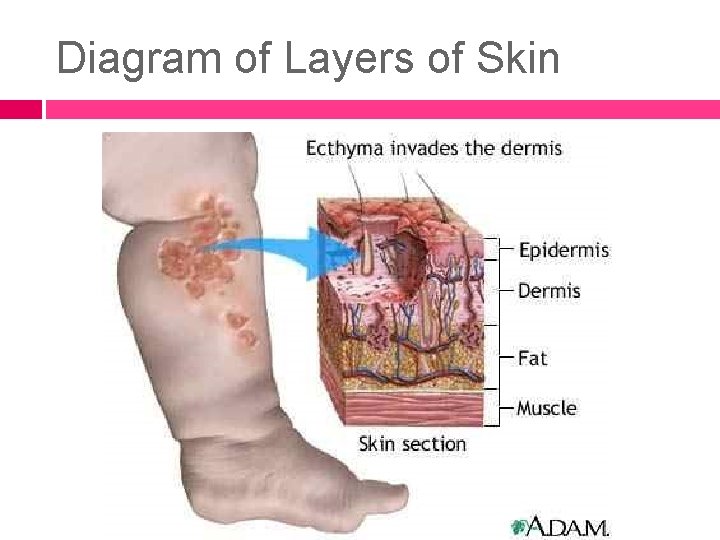 Diagram of Layers of Skin 