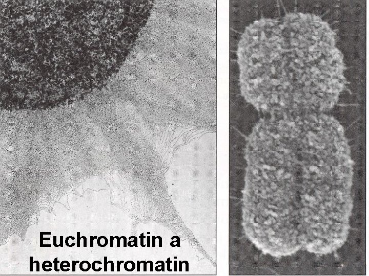 Euchromatin a heterochromatin 