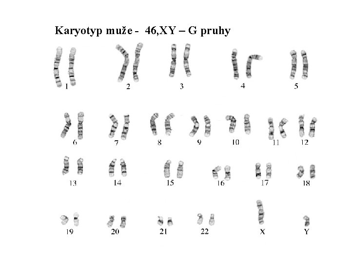 Karyotyp muže - 46, XY – G pruhy 