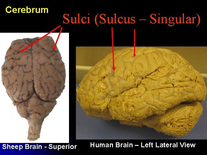 Cerebrum Sulci (Sulcus – Singular) Sheep Brain - Superior Human Brain – Left Lateral