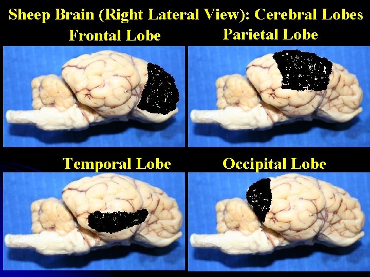 Sheep Brain (Right Lateral View): Cerebral Lobes Parietal Lobe Frontal Lobe Temporal Lobe Occipital