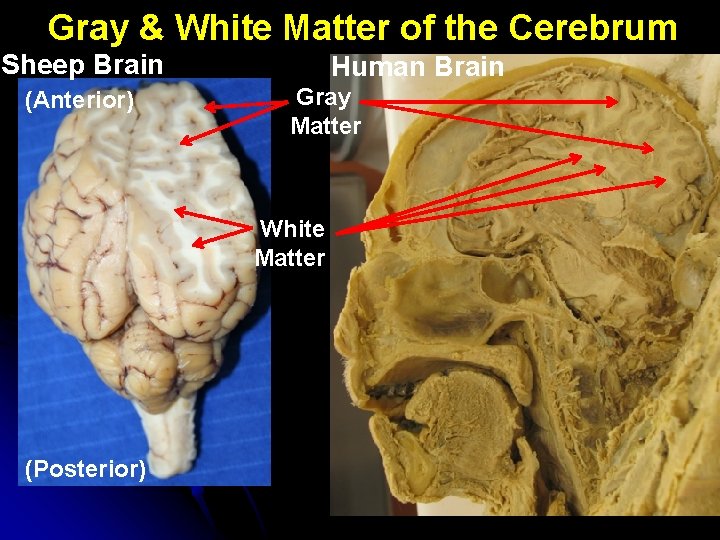 Gray & White Matter of the Cerebrum Sheep Brain (Anterior) Human Brain Gray Matter
