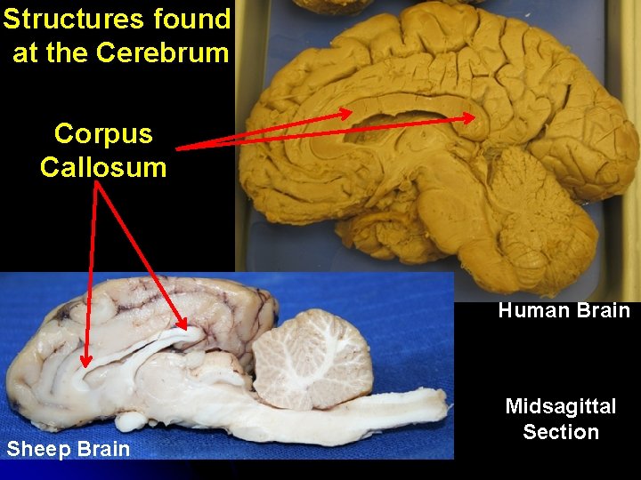Structures found at the Cerebrum Corpus Callosum Human Brain Sheep Brain Midsagittal Section 