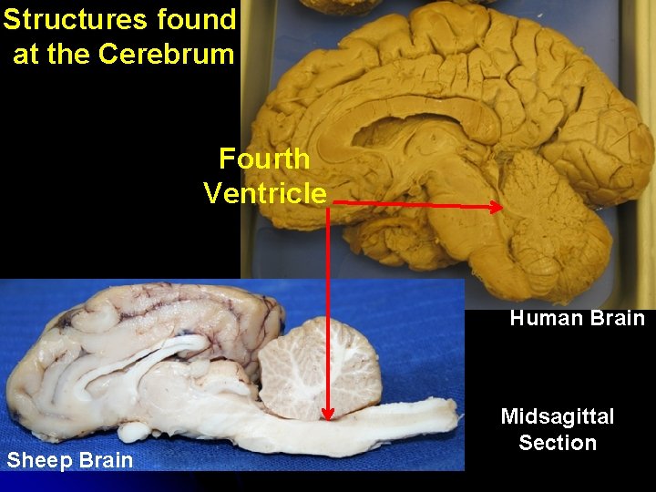 Structures found at the Cerebrum Fourth Ventricle Human Brain Sheep Brain Midsagittal Section 