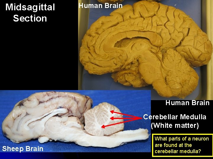 Midsagittal Section Human Brain Cerebellar Medulla (White matter) Sheep Brain What parts of a Midsagittal Section Human Brain Cerebellar Medulla (White matter) Sheep Brain What parts of a