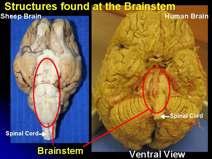 Structures found at the Brainstem Sheep Brain Human Brain Spinal Cord Brainstem Ventral View