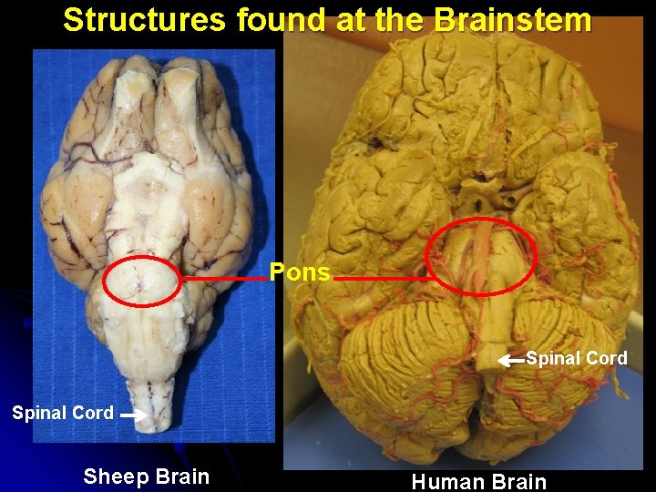 Structures found at the Brainstem Pons Spinal Cord Sheep Brain Human Brain 