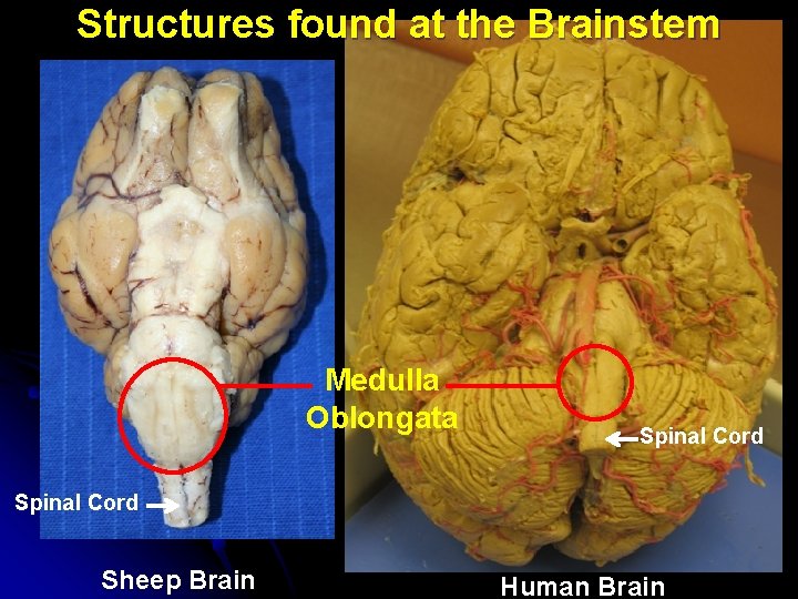 Structures found at the Brainstem Medulla Oblongata Spinal Cord Sheep Brain Human Brain 