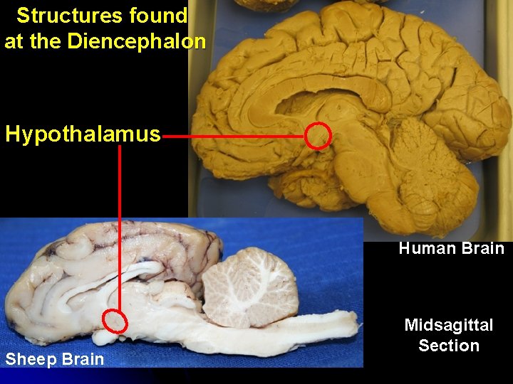 Structures found at the Diencephalon Hypothalamus Human Brain Sheep Brain Midsagittal Section Structures found at the Diencephalon Hypothalamus Human Brain Sheep Brain Midsagittal Section