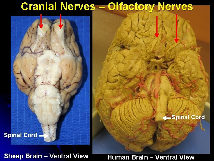 Cranial Nerves – Olfactory Nerves Spinal Cord Sheep Brain – Ventral View Human Brain Cranial Nerves – Olfactory Nerves Spinal Cord Sheep Brain – Ventral View Human Brain