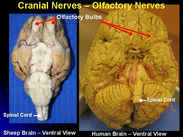Cranial Nerves – Olfactory Nerves Olfactory Bulbs Spinal Cord Sheep Brain – Ventral View