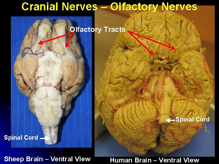 Cranial Nerves – Olfactory Nerves Olfactory Tracts Spinal Cord Sheep Brain – Ventral View Cranial Nerves – Olfactory Nerves Olfactory Tracts Spinal Cord Sheep Brain – Ventral View