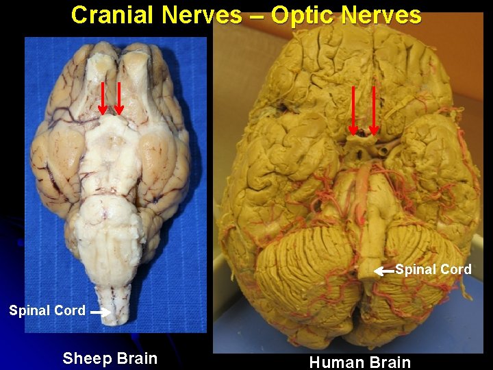 Cranial Nerves – Optic Nerves Spinal Cord Sheep Brain Human Brain 