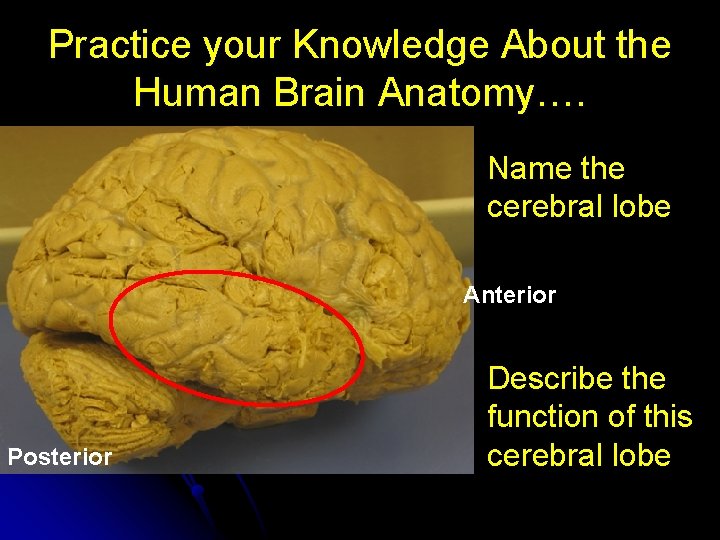 Practice your Knowledge About the Human Brain Anatomy…. Name the cerebral lobe Anterior Posterior