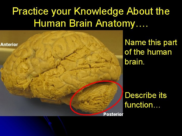 Practice your Knowledge About the Human Brain Anatomy…. Name this part of the human