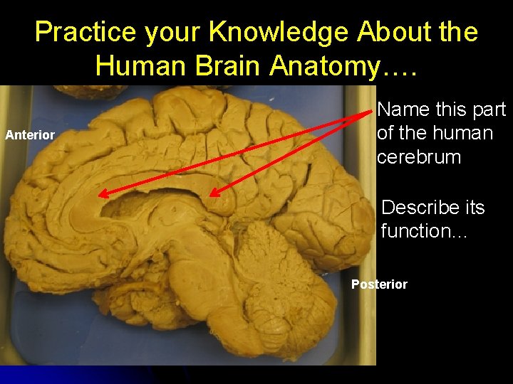 Practice your Knowledge About the Human Brain Anatomy…. Anterior Name this part of the