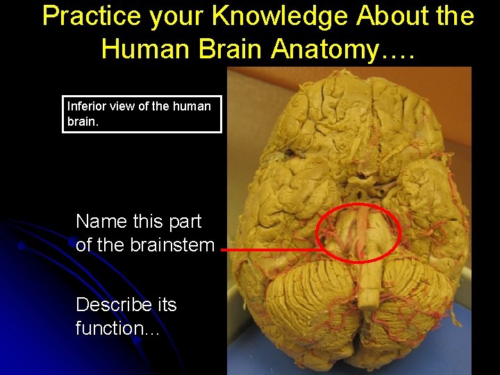 Practice your Knowledge About the Human Brain Anatomy…. Inferior view of the human brain.