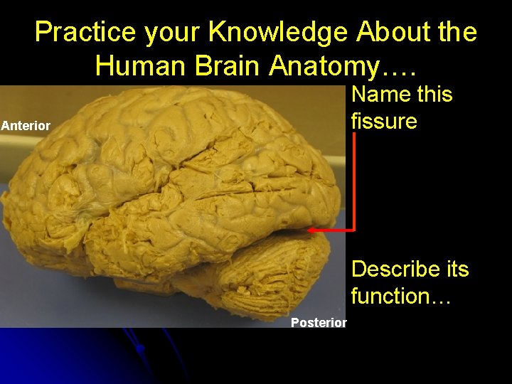 Practice your Knowledge About the Human Brain Anatomy…. Name this fissure Anterior Posterior Describe