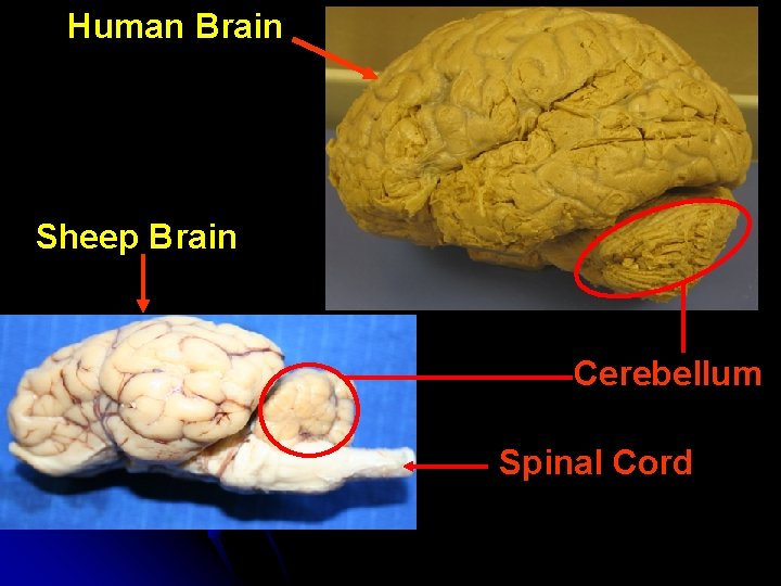 Human Brain Sheep Brain Cerebellum Spinal Cord 
