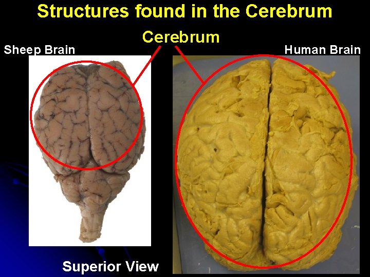 Structures found in the Cerebrum Sheep Brain Cerebrum Superior View Human Brain 