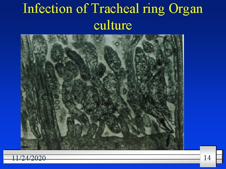 Infection of Tracheal ring Organ culture 11/24/2020 14 