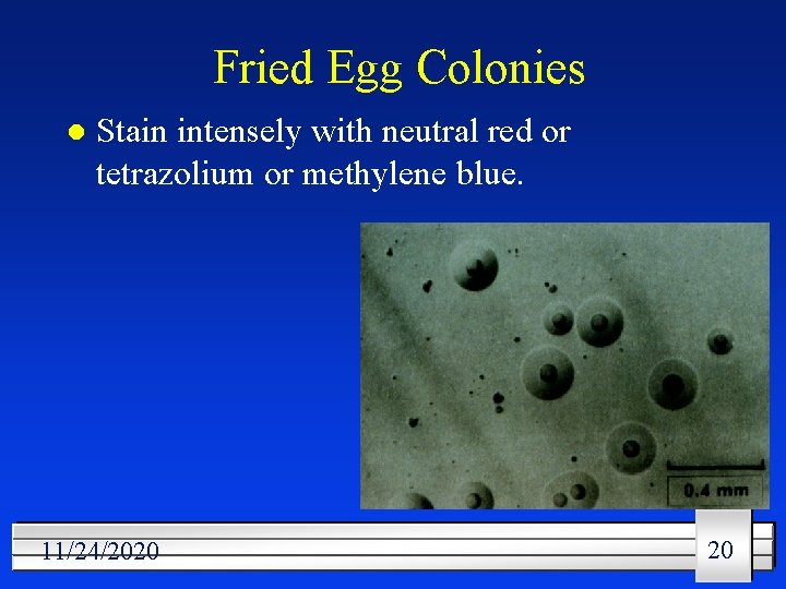 Fried Egg Colonies l Stain intensely with neutral red or tetrazolium or methylene blue.