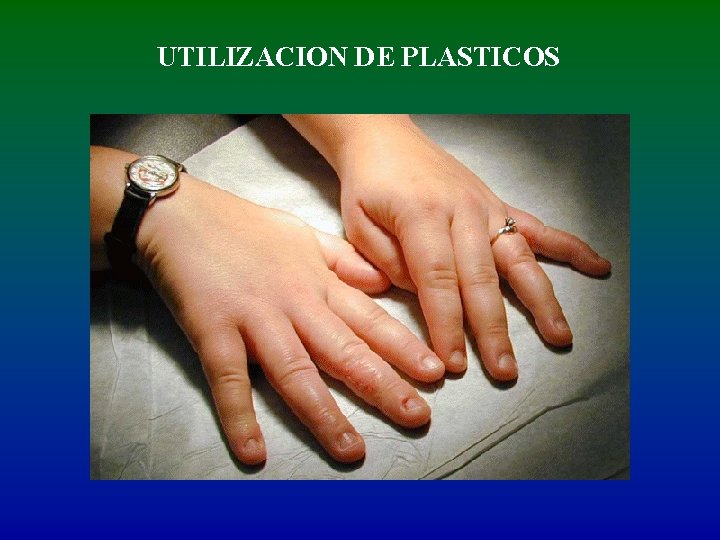 UTILIZACION DE PLASTICOS 