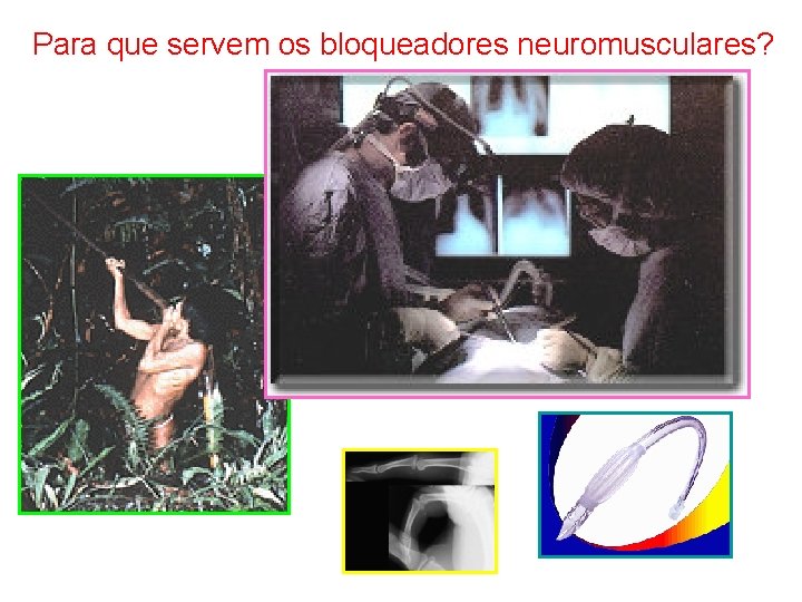 Para que servem os bloqueadores neuromusculares? 