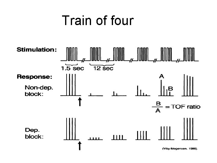 Train of four 