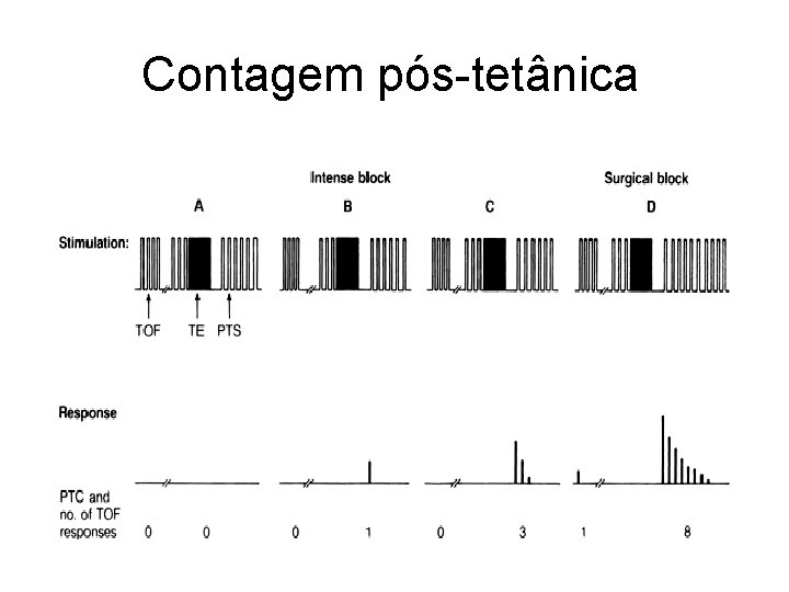 Contagem pós-tetânica 