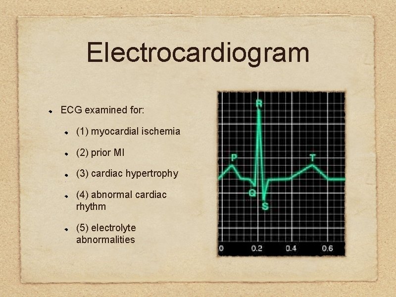 Electrocardiogram ECG examined for: (1) myocardial ischemia (2) prior MI (3) cardiac hypertrophy (4)