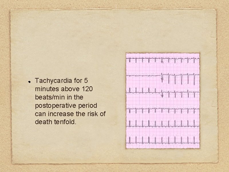 Tachycardia for 5 minutes above 120 beats/min in the postoperative period can increase the