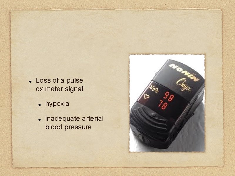 Loss of a pulse oximeter signal: hypoxia inadequate arterial blood pressure 