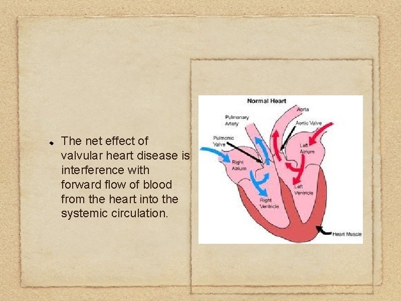 The net effect of valvular heart disease is interference with forward flow of blood