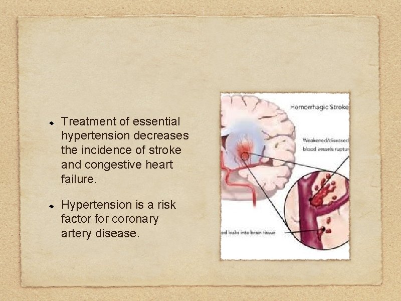 Treatment of essential hypertension decreases the incidence of stroke and congestive heart failure. Hypertension