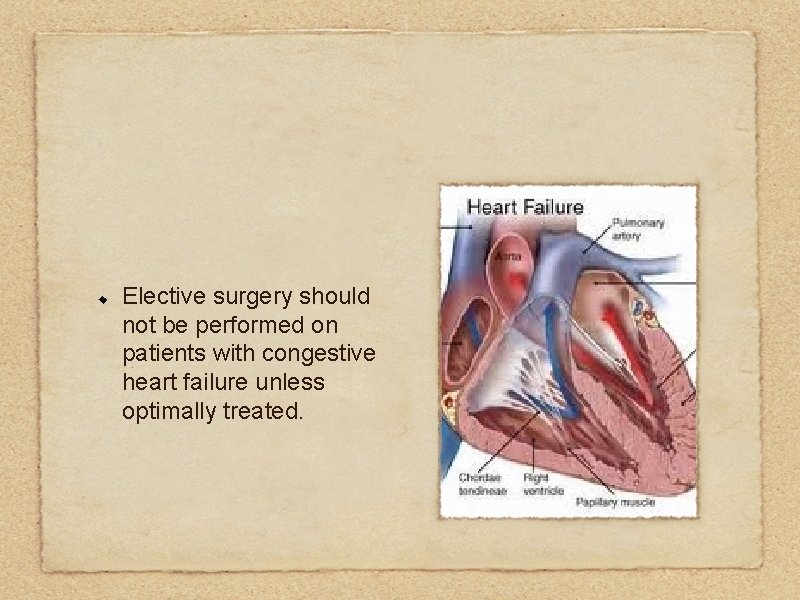 Elective surgery should not be performed on patients with congestive heart failure unless optimally