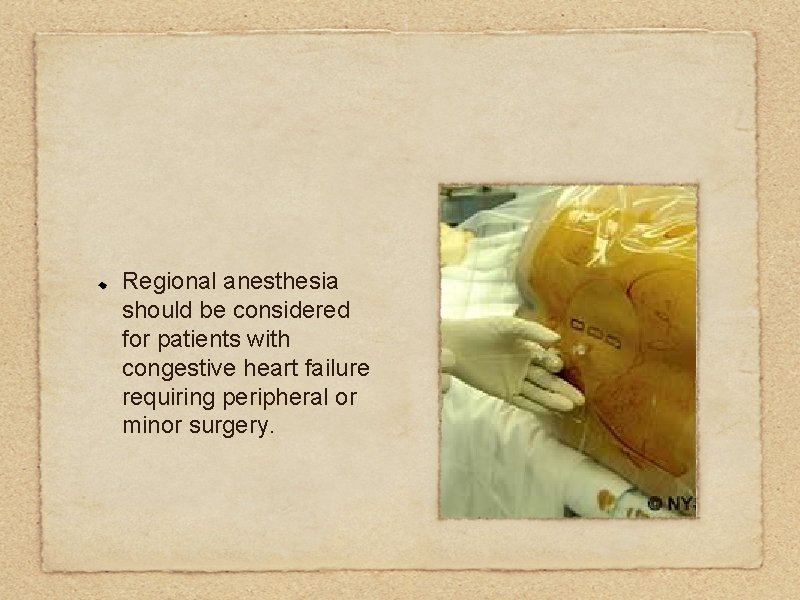 Regional anesthesia should be considered for patients with congestive heart failure requiring peripheral or