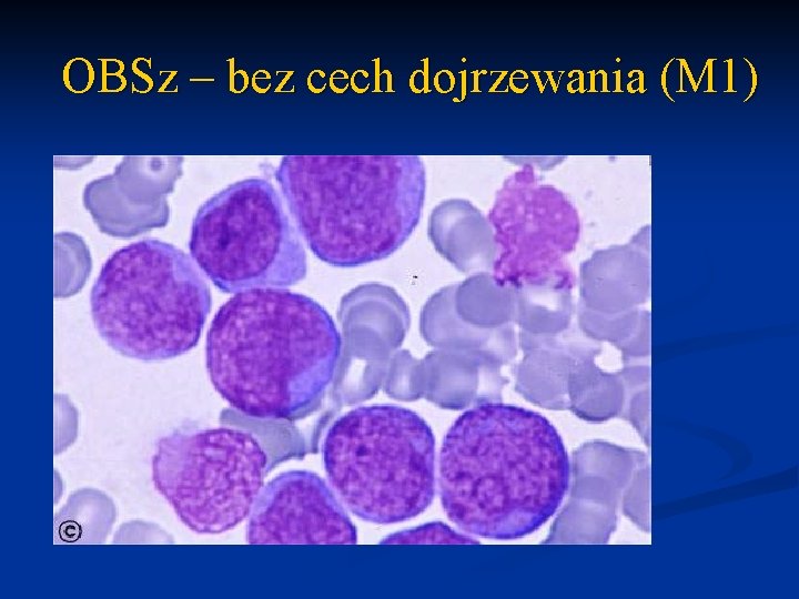 OBSz – bez cech dojrzewania (M 1) 