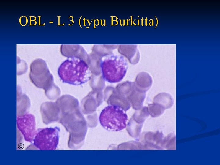 OBL - L 3 (typu Burkitta) 