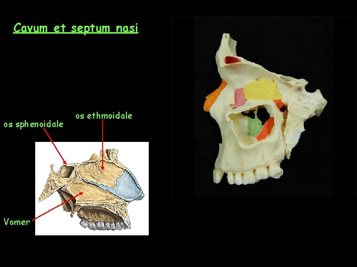 Cavum et septum nasi os sphenoidale Vomer os ethmoidale 