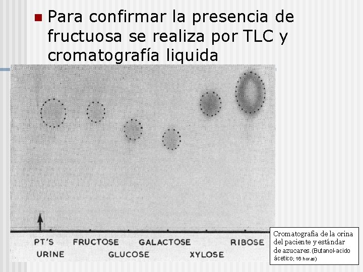 n Para confirmar la presencia de fructuosa se realiza por TLC y cromatografía liquida
