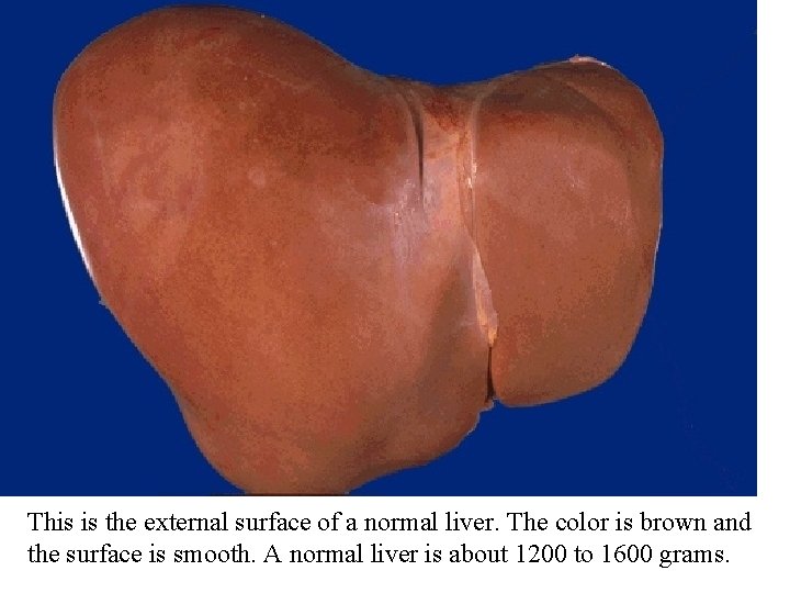 This is the external surface of a normal liver. The color is brown and