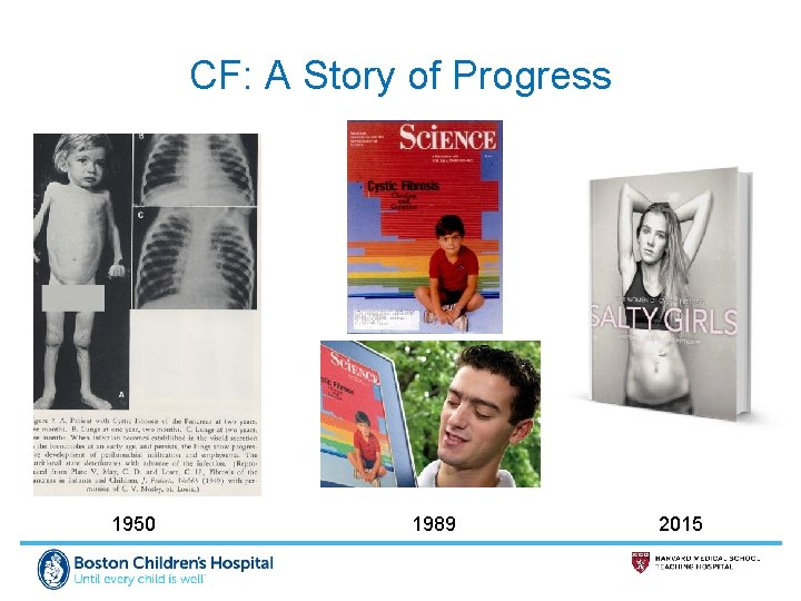 CF: A Story of Progress 1950 1989 2015 