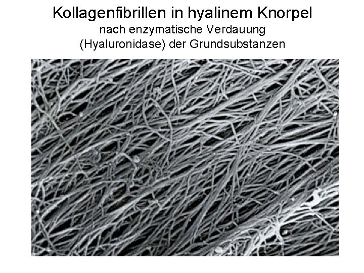 Kollagenfibrillen in hyalinem Knorpel nach enzymatische Verdauung (Hyaluronidase) der Grundsubstanzen 