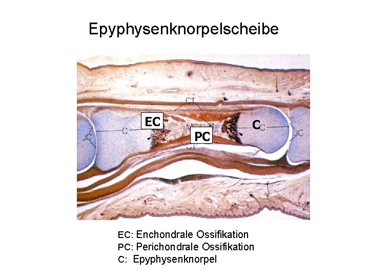 Epyphysenknorpelscheibe EC PC C EC: Enchondrale Ossifikation PC: Perichondrale Ossifikation C: Epyphysenknorpel 