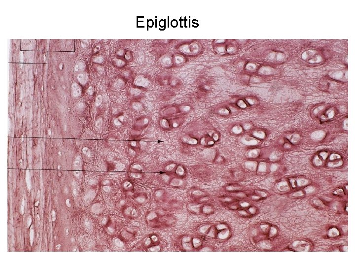 Epiglottis 