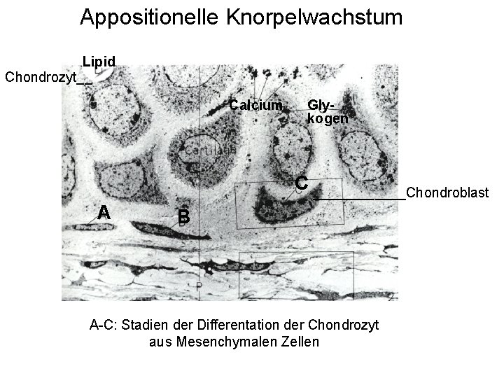 Appositionelle Knorpelwachstum Lipid Chondrozyt__ Calcium Glykogen C ______Chondroblast A B A-C: Stadien der Differentation
