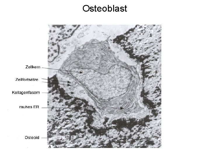 Osteoblast 
