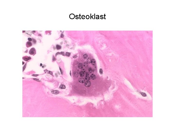 Osteoklast 