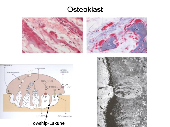 Osteoklast Howship-Lakune 